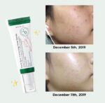 سرم ضد لک دارک اسپات اکسیس وای مدل AXIS-Y : Dark Spot Correcting Glow Serum