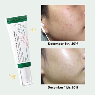 سرم ضد لک دارک اسپات اکسیس وای مدل AXIS-Y : Dark Spot Correcting Glow Serum