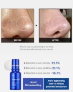 اگزوزوم شات برند مدیکیوب دوز 7500 مدل اگزوزوم‌ها (Exosomes)