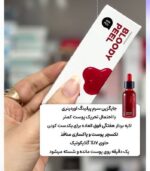 آمپول لایه بردار ملایم زامبی برند skin1004